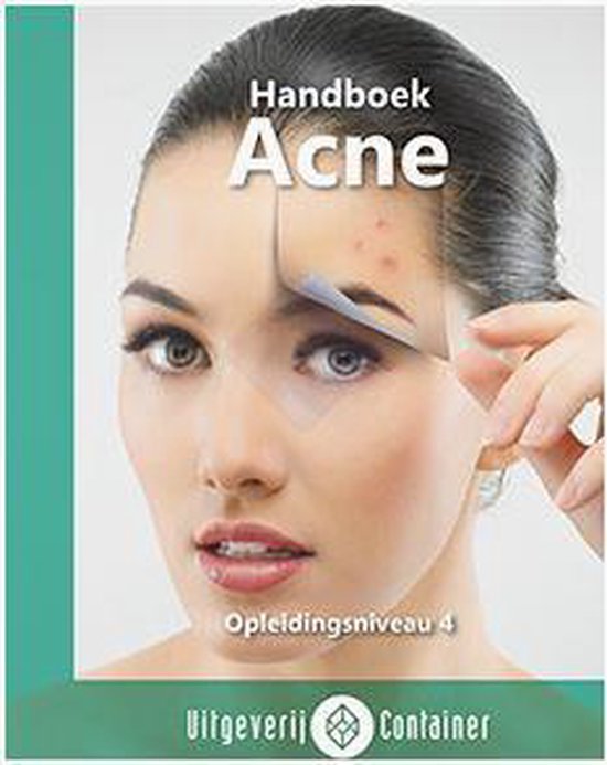 Handboek Acne