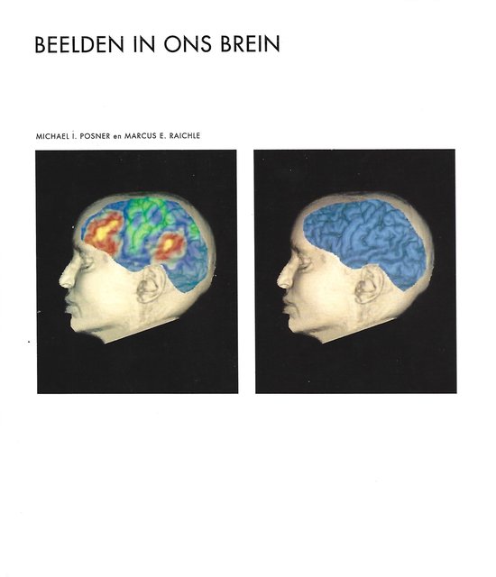 Beelden in ons brein