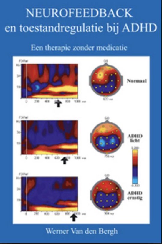 Neurofeedback en toestandregulatie bij adhd