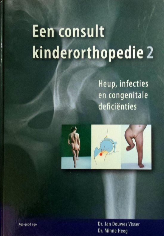 Een consult kinderorthopedie, deel 2