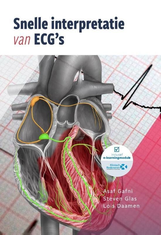 Snelle interpretatie van ECG's