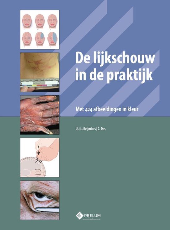 De lijkschouw in de praktijk