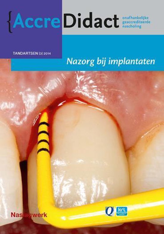 AccreDidact TA2014-3 -   Nazorg bij implantaten