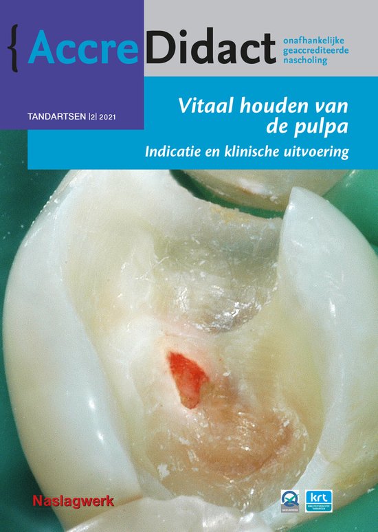 AccreDidact TA2021-2 - Vitaal houden van de pulpa