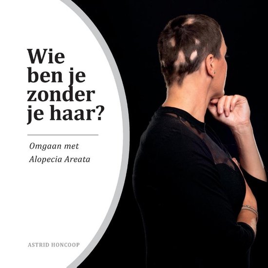 Wie ben je zonder je haar?