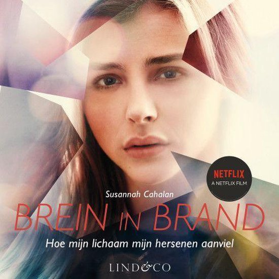 Brein in brand