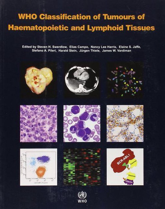 WHO classification of tumours of haematopoietic and lymphoid tissues: Vol. 2