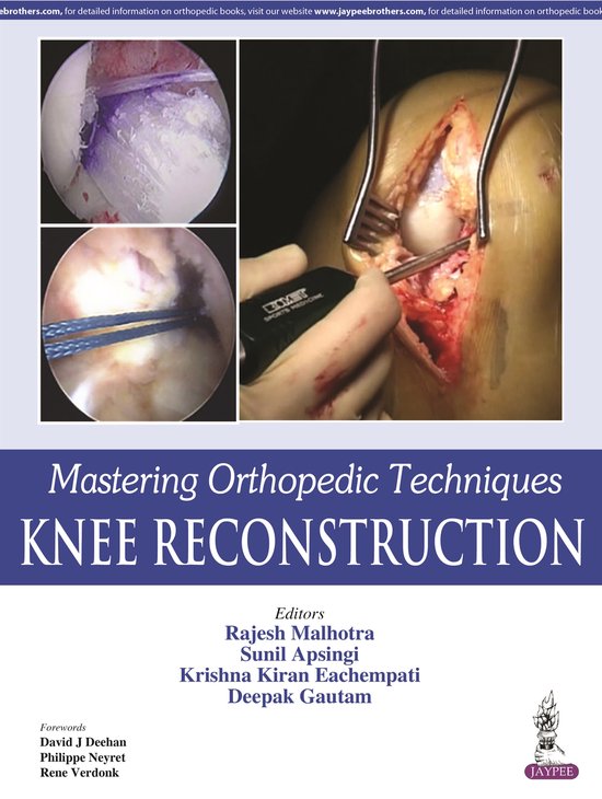 Mastering Orthopedic Techniques