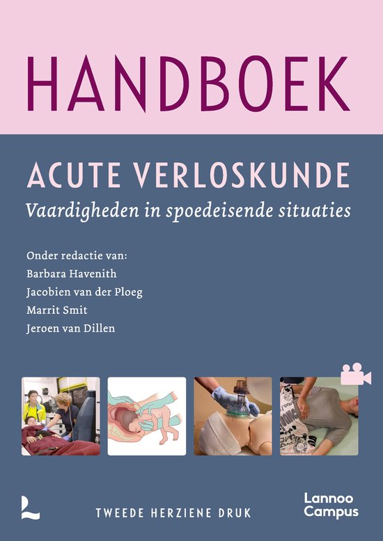 Handboek acute verloskunde