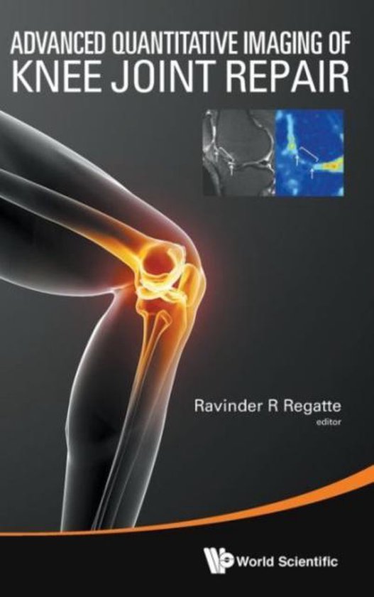 Advanced Quantitative Imaging of Knee Joint Repair